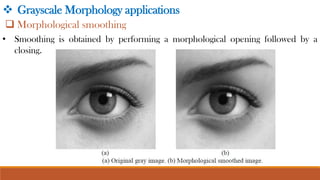 Morphological Image Processing and Image Segmentation.pdf