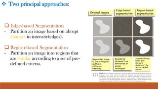 Morphological Image Processing and Image Segmentation.pdf