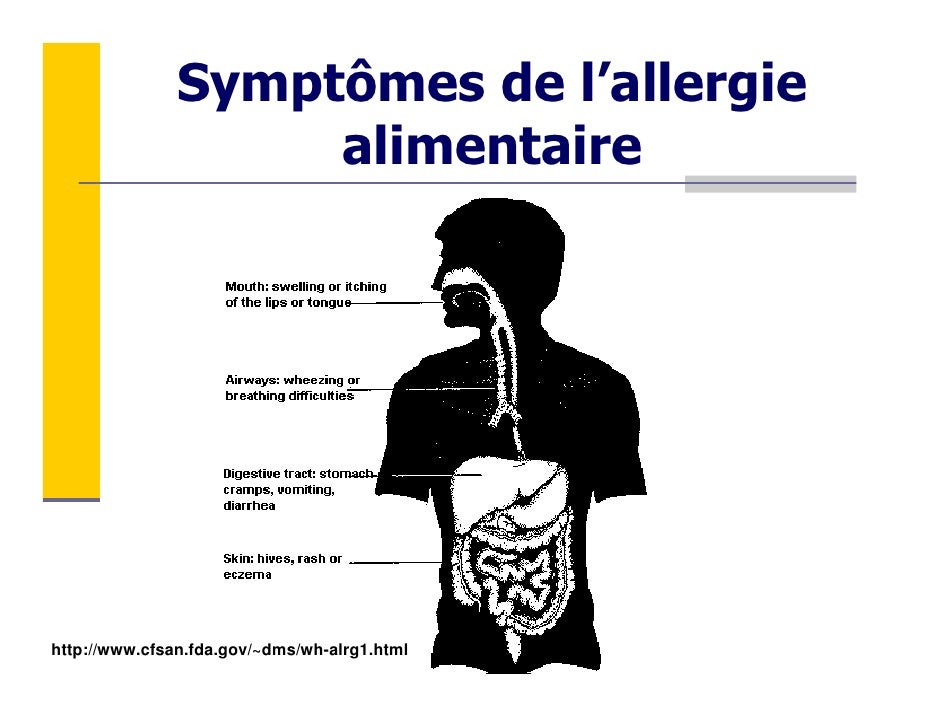 Module 5. Allergies et intolérances alimentaires Module 5. Allergies et intolérances alimentaires