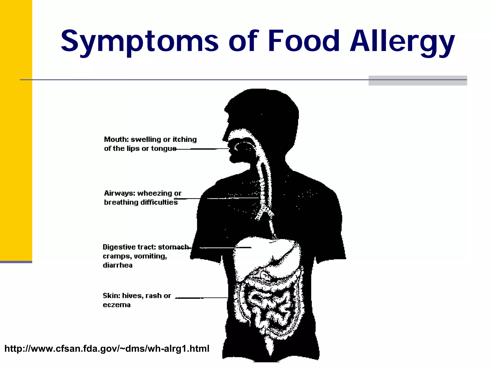 Module 5: Food Allergies and Intolerances | PDF