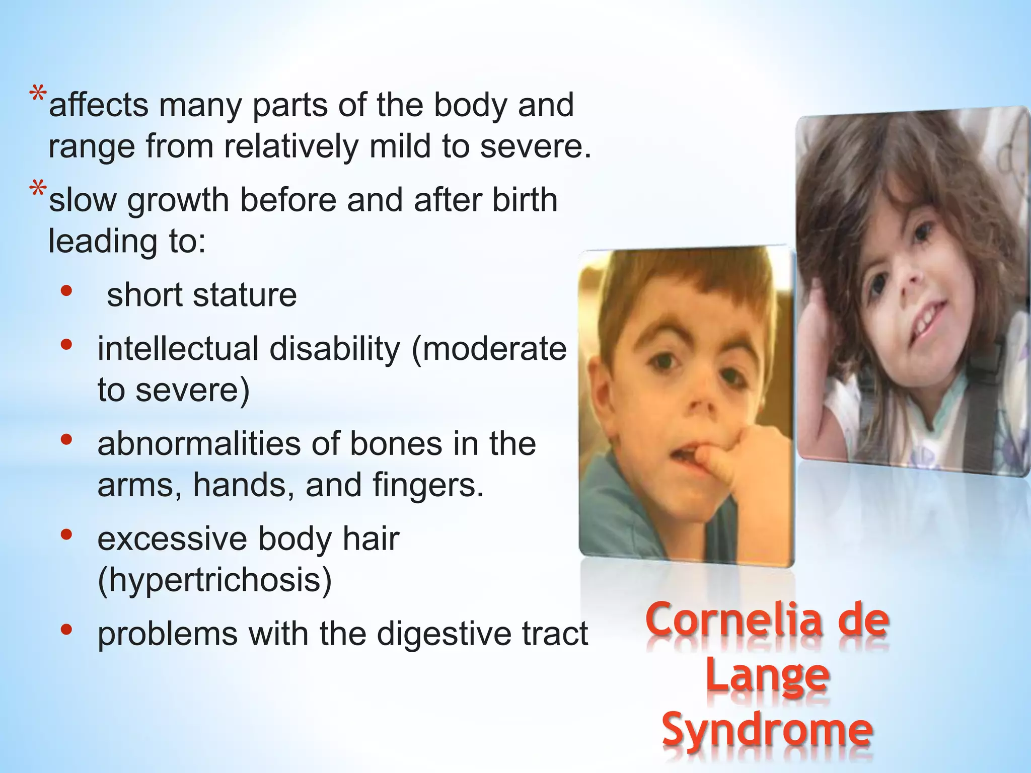 General guidelines for intellectual and developmental disabilities | PPTX