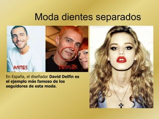 Moda dientes separados

En España, el diseñador David Delfín es
el ejemplo más famoso de los
seguidores de esta moda.

 