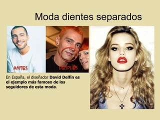 Moda dientes separados En España, el diseñador  David Delfín es el ejemplo más famoso de los seguidores de esta moda .  