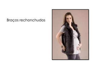 Braços rechonchudos
 