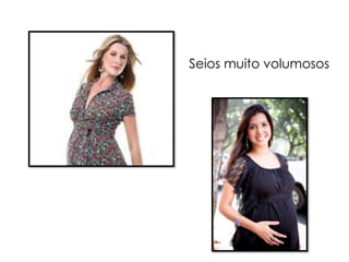 Seios muito volumosos
 