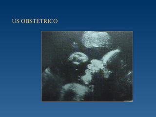 US OBSTETRICO 