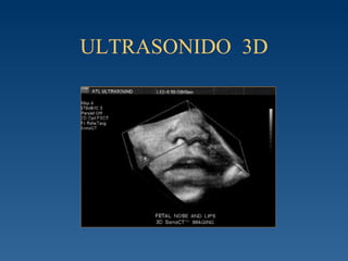 ULTRASONIDO  3D 