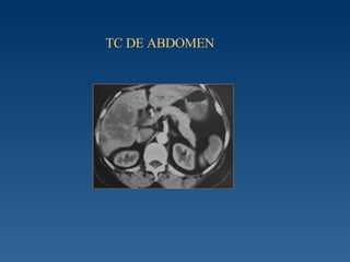 TC DE ABDOMEN 