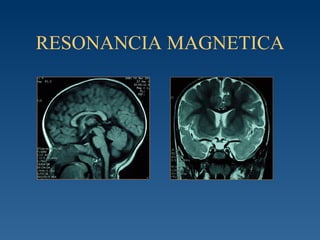 RESONANCIA MAGNETICA 