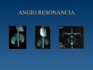 ANGIO RESONANCIA 