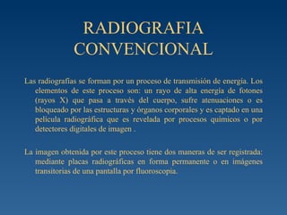 RADIOGRAFIA CONVENCIONAL Las radiografías se forman por un proceso de transmisión de energía. Los elementos de este proceso son: un rayo de alta energía de fotones (rayos X) que pasa a través del cuerpo, sufre atenuaciones o es bloqueado por las estructuras y órganos corporales y es captado en una película radiográfica que es revelada por procesos químicos o por detectores digitales de imagen  .   La imagen obtenida por este proceso tiene dos maneras de ser registrada: mediante placas radiográficas en forma permanente o en imágenes transitorias de una pantalla por fluoroscopia.  