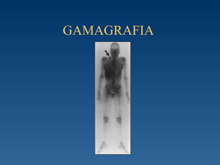 GAMAGRAFIA  