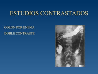 ESTUDIOS CONTRASTADOS COLON POR ENEMA DOBLE CONTRASTE 