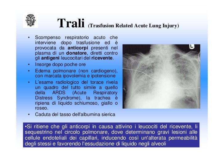 Gel da anguille risposte di telescrivente di acne