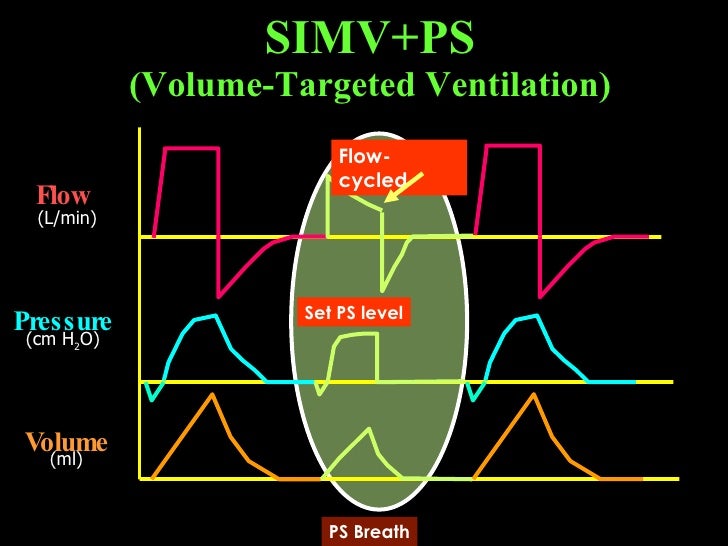 Mode Of Mechanical Ventilator