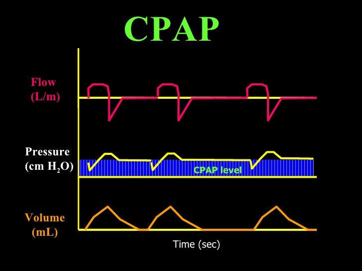 Mode Of Mechanical Ventilator