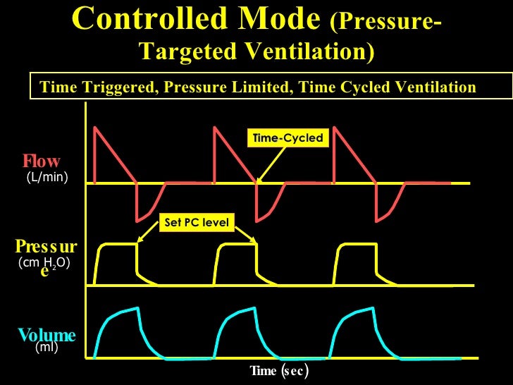 Mode Of Mechanical Ventilator
