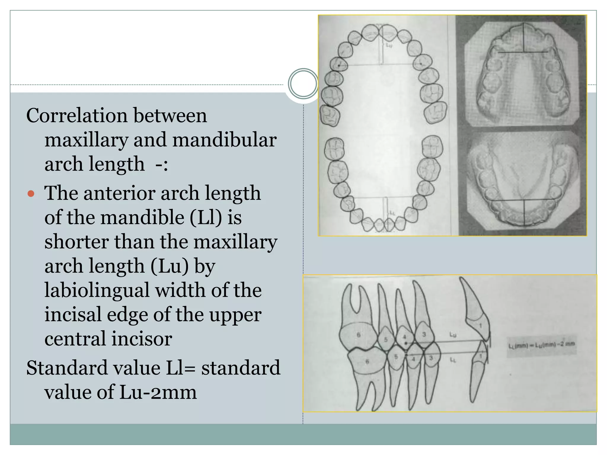 Correlation between
maxillary and mandibular
arch length -:
 The anterior arch length
of the mandible (Ll) is
shorter than the maxillary
arch length (Lu) by
labiolingual width of the
incisal edge of the upper
central incisor
Standard value Ll= standard
value of Lu-2mm
 