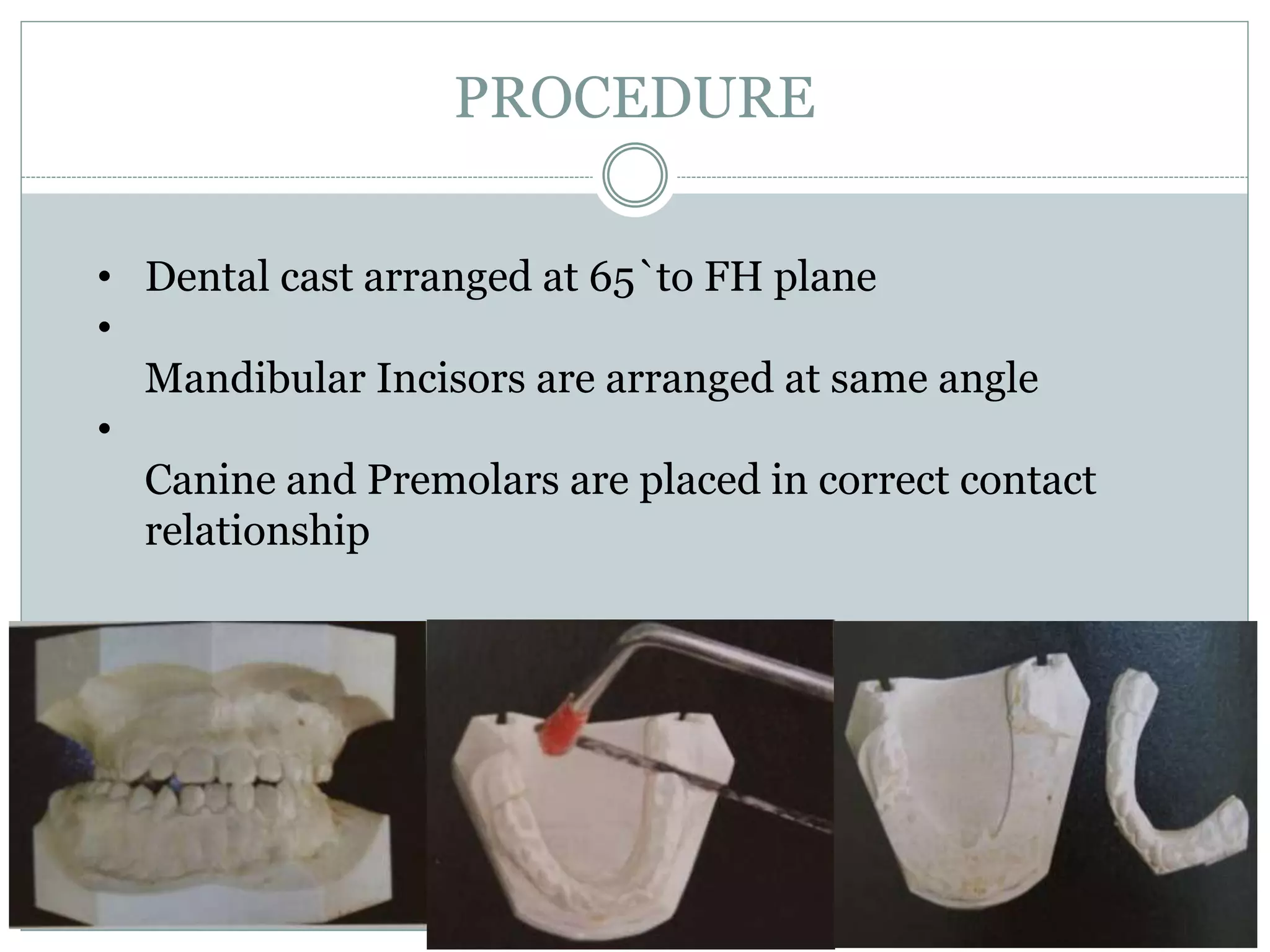 PROCEDURE
• Dental cast arranged at 65`to FH plane
•
Mandibular Incisors are arranged at same angle
•
Canine and Premolars are placed in correct contact
relationship
 