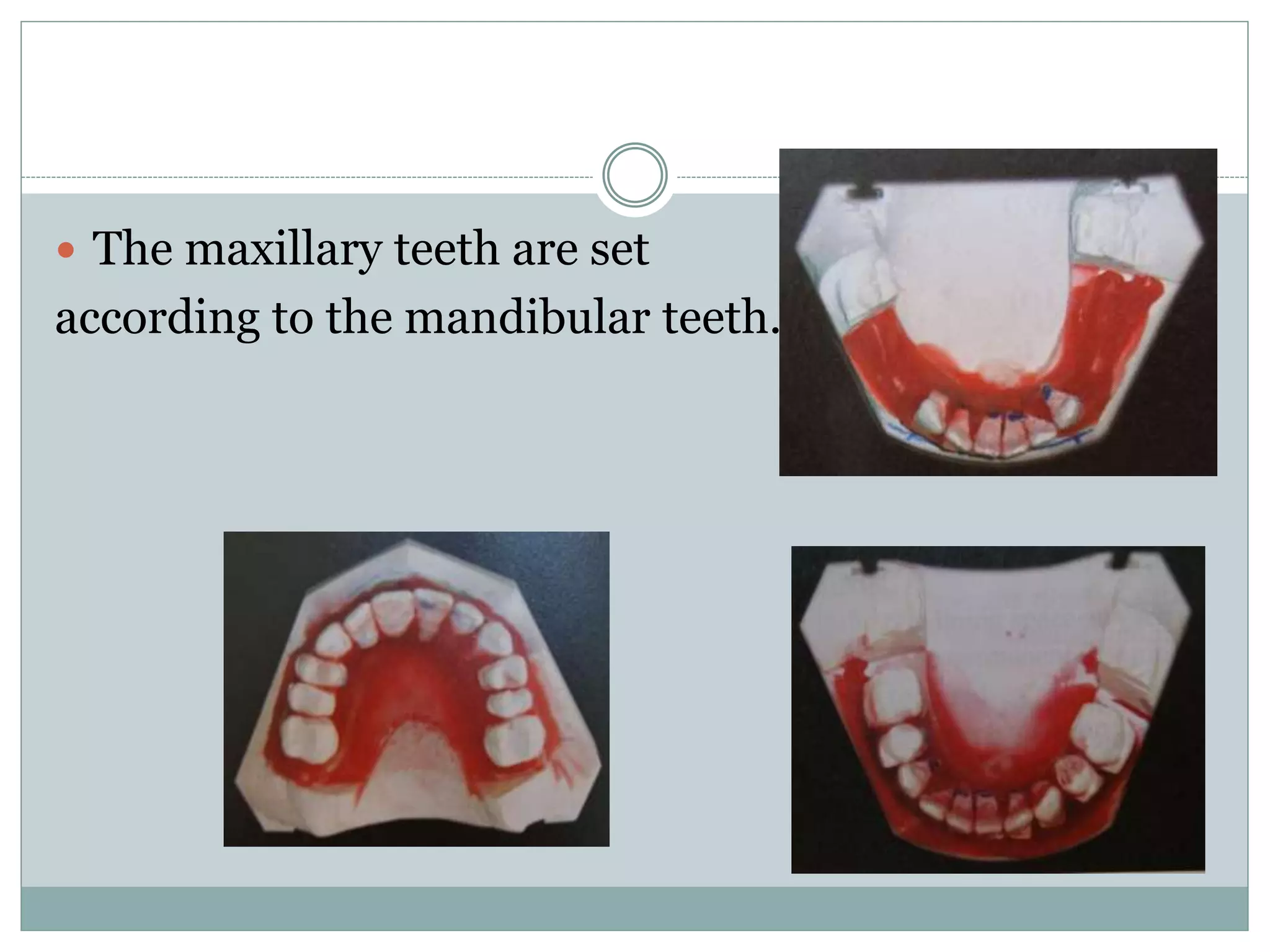  The maxillary teeth are set
according to the mandibular teeth.
 