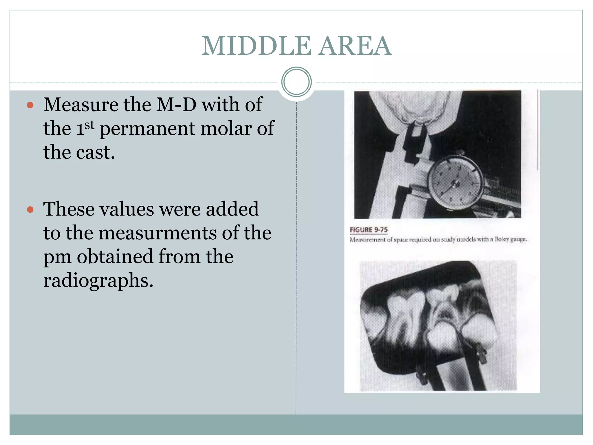 MIDDLE AREA
 Measure the M-D with of
the 1st permanent molar of
the cast.
 These values were added
to the measurments of the
pm obtained from the
radiographs.
 