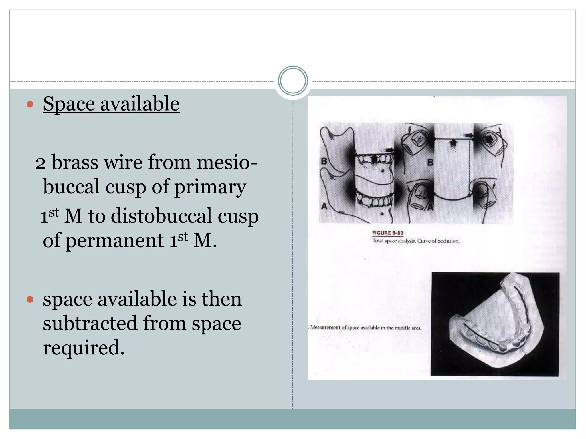  Space available
2 brass wire from mesio-
buccal cusp of primary
1st M to distobuccal cusp
of permanent 1st M.
 space available is then
subtracted from space
required.
 
