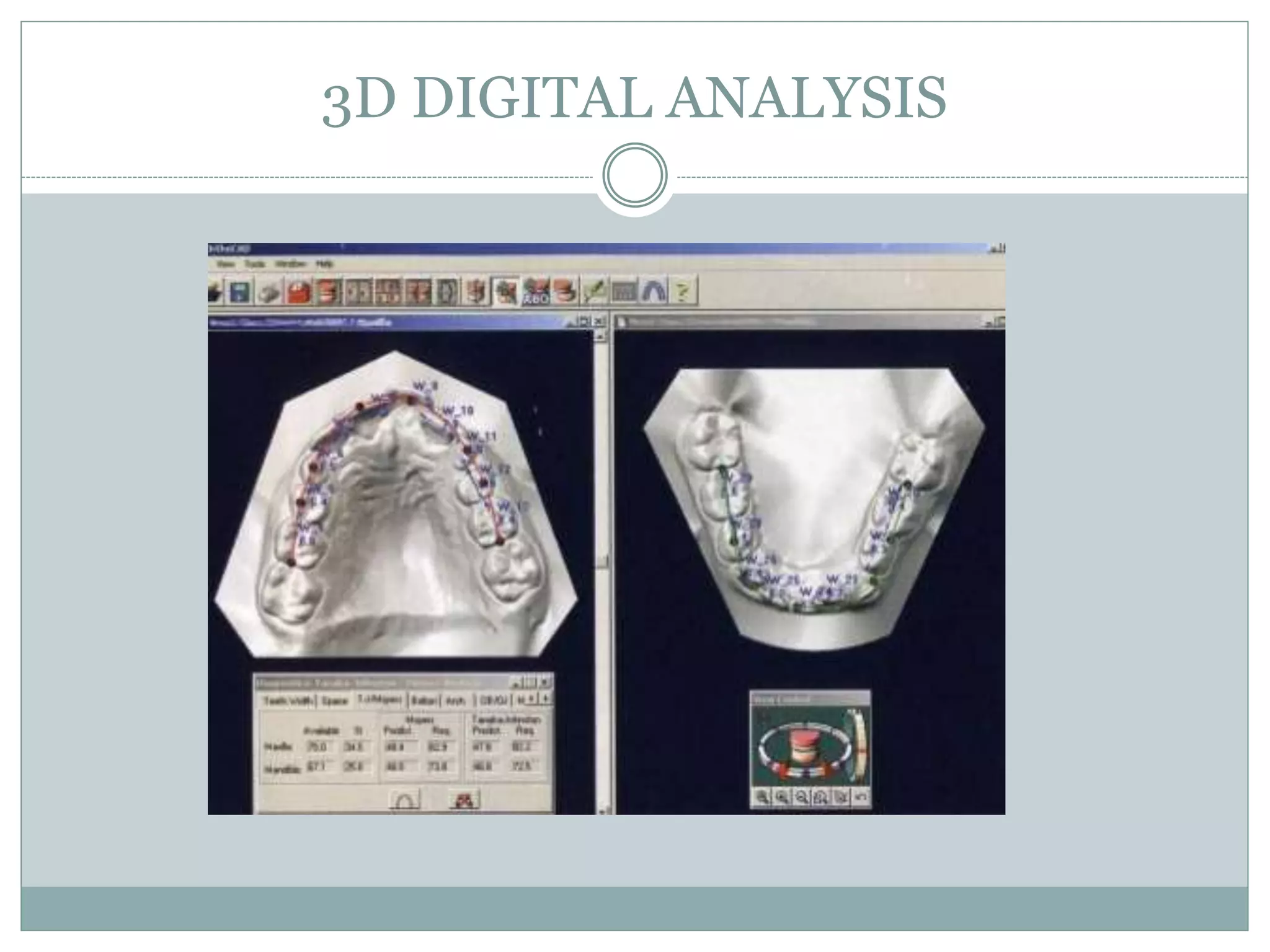 3D DIGITAL ANALYSIS
 
