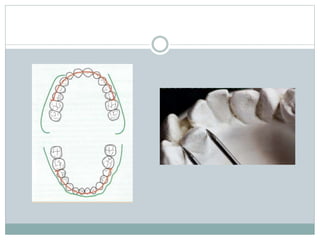 Pont Model Analysis Inference Model analysis in orthodontics | PPTX