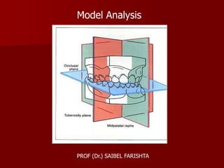 Model Analysis
PROF (Dr.) SAIBEL FARISHTA
 
