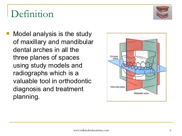be trimmed will model maxillary a fixed orthodontics in analysis /certified Model be trimmed will model maxillary a fixed orthodontics in analysis /certified Model