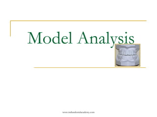 Model Analysis
www.indiandentalacademy.com
 
