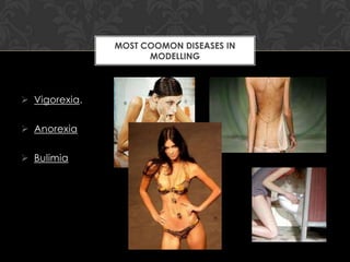 MOST COOMON DISEASES IN
                     MODELLING




 Vigorexia.

 Anorexia

 Bulimia
 
