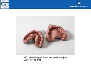 A01 - Moulding of the upper and lower jaw
A01- 上下颚取模
 