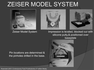 Zeiser System Model and die material | PPTX