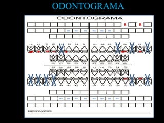 ODONTOGRAMA
R R
DES DES DES DES DES DES
DESDESDESDESDES DES DESDES
 