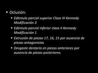 Oclusión:
 Edéntulo parcial superior Clase III Kennedy
Modificación 3
 Edéntulo parcial inferior clase II Kennedy
Modificación 1
 Extrusión de piezas 17, 16, 15 por ausencia de
piezas antagonistas
 Desgaste dentario en piezas anteriores por
ausencia de piezas posteriores.
 