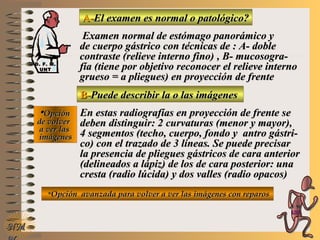A-A-El examen es normal o patológico?El examen es normal o patológico?
Examen normal de estómago panorámico yExamen normal de estómago panorámico y
de cuerpo gástrico con técnicas de : A- doblede cuerpo gástrico con técnicas de : A- doble
contraste (relieve interno fino)contraste (relieve interno fino) , B- mucosogra-, B- mucosogra-
fía (tiene por objetivo reconocer el relieve internofía (tiene por objetivo reconocer el relieve interno
grueso = a pliegues) en proyección de frentegrueso = a pliegues) en proyección de frente
B-B-Puede describir la o las imágenesPuede describir la o las imágenes
**OpciónOpción
de volverde volver
a ver lasa ver las
imágenesimágenes
En estas radiografías en proyección de frente seEn estas radiografías en proyección de frente se
deben distinguir: 2deben distinguir: 2 curvaturas (menor y mayor),curvaturas (menor y mayor),
4 segmentos (techo, cuerpo, fondo y antro gástri-4 segmentos (techo, cuerpo, fondo y antro gástri-
co) con el trazado de 3 líneas. Se puede precisarco) con el trazado de 3 líneas. Se puede precisar
la presencia de pliegues gástricos de cara anteriorla presencia de pliegues gástricos de cara anterior
(delineados a lápiz) de los de cara posterior: una(delineados a lápiz) de los de cara posterior: una
cresta (radio lúcida) y dos valles (radio opacos)cresta (radio lúcida) y dos valles (radio opacos)
**Opción avanzada para volver a ver las imágenes con reparosOpción avanzada para volver a ver las imágenes con reparos
NMNM
D. F. M.D. F. M.
UNTUNT
E ME M
UNTUNT
 