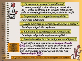 A-A-El examen es normal o patológico?El examen es normal o patológico?
Examen patológico de estómago con técnicaExamen patológico de estómago con técnica
de A- doble contraste y B- relleno total, locali-de A- doble contraste y B- relleno total, locali-
zada en cuerpo gástrico en proyección de perfilzada en cuerpo gástrico en proyección de perfil
B-B-La patología es congénita o adquirida?La patología es congénita o adquirida?
Patología adquiridaPatología adquirida
D-D-La misma es neoplásica o no neoplásica?La misma es neoplásica o no neoplásica?
**OpciónOpción
de volverde volver
a ver lasa ver las
imágenesimágenes
Patología adquirida orgánica neoplásicaPatología adquirida orgánica neoplásica
E-E-Puede describir la o las imágenes patológicas?Puede describir la o las imágenes patológicas?
Se identifica una voluminosaSe identifica una voluminosa imagen elevadaimagen elevada
UNTUNT , sesil, localizada en cara anterior de cuer-, sesil, localizada en cara anterior de cuer-
po gástrico compatible con lesión submucosapo gástrico compatible con lesión submucosa
por la presencia de pliegues en puente (verpor la presencia de pliegues en puente (ver
TerminologíaTerminología UNTUNT ))
NMNM
C-C-Dicha patología es orgánica, funcional o mixta?Dicha patología es orgánica, funcional o mixta?
Patología adquirida orgánicaPatología adquirida orgánica
**Opción avanzada para volver a ver las imágenes con reparosOpción avanzada para volver a ver las imágenes con reparos
D. F. M.D. F. M.
UNTUNT
E ME M
UNTUNT
 