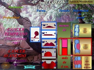 ParámetrosParámetros
ProfundidadProfundidad
FormaForma TamaTamañoño DeformidadDeformidad
dede
paredpared
CANCERCANCER
TEMPRANOTEMPRANO
(Maruyama)(Maruyama)
““M”M”
CANCERCANCER
AVANZADOAVANZADO
(Borrmann)(Borrmann)
““B”B”
menosmenos
dede
2 cm.2 cm.
másmás
dede
4 cm.4 cm.
d -d -d -d -
d +d +d +d +
dd
++++
dd
++++
C. A. de COLONC. A. de COLON
NMNM volvervolver
++++++
++++++++
“M” a
““MM ” b” b
““MM ” c” c
““MM ” d” d
““BB ” I” I
““BB ” II” II
Foto de N. Mercado NietoFoto de N. Mercado Nieto
 