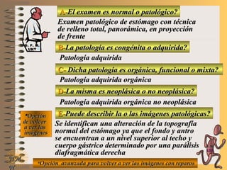 NMNM
N
A-A-El examen es normal o patológico?El examen es normal o patológico?
Examen patológico de estómago con técnicaExamen patológico de estómago con técnica
de relleno total, panorámica, en proyecciónde relleno total, panorámica, en proyección
de frentede frente
B-B-La patología es congénita o adquirida?La patología es congénita o adquirida?
Patología adquiridaPatología adquirida
C-C- Dicha patología es orgánica, funcional o mixta?Dicha patología es orgánica, funcional o mixta?
**OpciónOpción
de volverde volver
a ver lasa ver las
imágenesimágenes
Patología adquirida orgánicaPatología adquirida orgánica
D-D-La misma es neoplásica o no neoplásica?La misma es neoplásica o no neoplásica?
Patología adquirida orgánica no neoplásicaPatología adquirida orgánica no neoplásica
E-E-Puede describir la o las imágenes patológicas?Puede describir la o las imágenes patológicas?
Se identifican una alteración de la topografíaSe identifican una alteración de la topografía
normal del estómago ya que el fondo y antronormal del estómago ya que el fondo y antro
se encuentran a un nivel superior al techo yse encuentran a un nivel superior al techo y
cuerpo gástrico determinado por una parálisiscuerpo gástrico determinado por una parálisis
diafragmática derechadiafragmática derecha
**Opción avanzada para volver a ver las imágenes con reparosOpción avanzada para volver a ver las imágenes con reparos
D. F. M.D. F. M.
UNTUNT
E ME M
UNTUNT
 