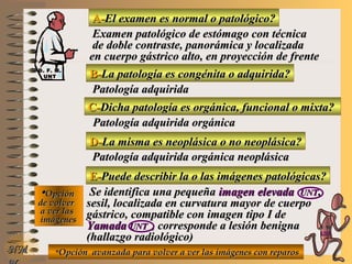 A-A-El examen es normal o patológico?El examen es normal o patológico?
Examen patológico de estómago con técnicaExamen patológico de estómago con técnica
de doble contraste, panorámica y localizadade doble contraste, panorámica y localizada
en cuerpo gástrico alto, en proyección de frenteen cuerpo gástrico alto, en proyección de frente
B-B-La patología es congénita o adquirida?La patología es congénita o adquirida?
Patología adquiridaPatología adquirida
D-D-La misma es neoplásica o no neoplásica?La misma es neoplásica o no neoplásica?
**OpciónOpción
de volverde volver
a ver lasa ver las
imágenesimágenes
Patología adquirida orgánica neoplásicaPatología adquirida orgánica neoplásica
E-E-Puede describir la o las imágenes patológicas?Puede describir la o las imágenes patológicas?
Se identifica una pequeñaSe identifica una pequeña imagen elevadaimagen elevada UNTUNT,,
sesil, localizada en curvatura mayor de cuerposesil, localizada en curvatura mayor de cuerpo
gástrico, compatible con imagen tipo I degástrico, compatible con imagen tipo I de
YamadaYamada UNTUNT , corresponde a lesión benigna, corresponde a lesión benigna
(hallazgo radiológico)(hallazgo radiológico)
NMNM
C-C-Dicha patología es orgánica, funcional o mixta?Dicha patología es orgánica, funcional o mixta?
Patología adquirida orgánicaPatología adquirida orgánica
**Opción avanzada para volver a ver las imágenes con reparosOpción avanzada para volver a ver las imágenes con reparos
D. F. M.D. F. M.
UNTUNT
E ME M
UNTUNT
 