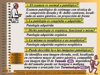 A-A-El examen es normal o patológico?El examen es normal o patológico?
Examen patológico de estómago con técnica deExamen patológico de estómago con técnica de
A- compresión dosada y B- doble contraste, locali-A- compresión dosada y B- doble contraste, locali-
zada en antro gástrico, en proyección de frentezada en antro gástrico, en proyección de frente
B-B-La patología es congénita o adquirida?La patología es congénita o adquirida?
Patología adquiridaPatología adquirida
D-D-La misma es neoplásica o no neoplásica?La misma es neoplásica o no neoplásica?
**OpciónOpción
de volverde volver
a ver lasa ver las
imágenesimágenes
Patología adquirida orgánica neoplásicaPatología adquirida orgánica neoplásica
E-E-Puede describir la o las imágenes patológicas?Puede describir la o las imágenes patológicas?
Se identifica una imagen elevada, sesil, localizadaSe identifica una imagen elevada, sesil, localizada
en curvatura mayor de antro gástrico, compatibleen curvatura mayor de antro gástrico, compatible
con imagen tipo II decon imagen tipo II de YamadaYamada UNTUNT ,, dependien-dependien-
do del tamaño puede ser benigna o malignado del tamaño puede ser benigna o maligna
temprana o avanzada (vertemprana o avanzada (ver TerminologíaTerminología UNTUNT ))
NMNM
C-C-Dicha patología es orgánica, funcional o mixta?Dicha patología es orgánica, funcional o mixta?
Patología adquirida orgánicaPatología adquirida orgánica
**Opción avanzada para volver a ver las imágenes con reparosOpción avanzada para volver a ver las imágenes con reparos
D. F. M.D. F. M.
UNTUNT
E ME M
UNTUNT
 