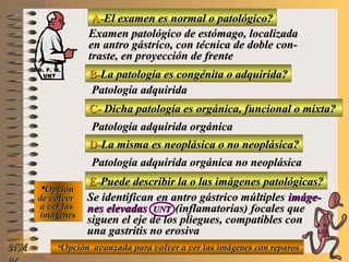 A-A-El examen es normal o patológico?El examen es normal o patológico?
Examen patológico de estómago, localizadaExamen patológico de estómago, localizada
en antro gástrico, con técnica de doble con-en antro gástrico, con técnica de doble con-
traste, en proyección de frentetraste, en proyección de frente
B-B-La patología es congénita o adquirida?La patología es congénita o adquirida?
Patología adquiridaPatología adquirida
C-C- Dicha patología es orgánica, funcional o mixta?Dicha patología es orgánica, funcional o mixta?
**OpciónOpción
de volverde volver
a ver lasa ver las
imágenesimágenes
Patología adquirida orgánicaPatología adquirida orgánica
D-D-La misma es neoplásica o no neoplásica?La misma es neoplásica o no neoplásica?
Patología adquirida orgánica no neoplásicaPatología adquirida orgánica no neoplásica
E-E-Puede describir la o las imágenes patológicas?Puede describir la o las imágenes patológicas?
Se identifican en antro gástrico múltiplesSe identifican en antro gástrico múltiples imáge-imáge-
nes elevadasnes elevadas UNTUNT (inflamatorias) focales que(inflamatorias) focales que
siguen el eje de los pliegues, compatibles consiguen el eje de los pliegues, compatibles con
una gastritis no erosivauna gastritis no erosiva
**Opción avanzada para volver a ver las imágenes con reparosOpción avanzada para volver a ver las imágenes con reparosNMNM
D. F. M.D. F. M.
UNTUNT
E ME M
UNTUNT
 