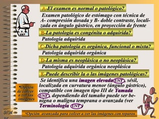 A-A-El examen es normal o patológico?El examen es normal o patológico?
Examen patológico de estómago con técnica deExamen patológico de estómago con técnica de
A- compresión dosada y B- doble contraste, locali-A- compresión dosada y B- doble contraste, locali-
zada en ángulo gástrico, en proyección de frentezada en ángulo gástrico, en proyección de frente
B-B-La patología es congénita o adquirida?La patología es congénita o adquirida?
Patología adquiridaPatología adquirida
D-D-La misma es neoplásica o no neoplásica?La misma es neoplásica o no neoplásica?
**OpciónOpción
de volverde volver
a ver lasa ver las
imágenesimágenes
Patología adquirida orgánica neoplásicaPatología adquirida orgánica neoplásica
E-E-Puede describir la o las imágenes patológicas?Puede describir la o las imágenes patológicas?
Se identifica unaSe identifica una imagen elevadaimagen elevada UNTUNT , sésil,, sésil,
localizada en curvatura menor (ángulo gástrico),localizada en curvatura menor (ángulo gástrico),
compatible con imagen tipo III decompatible con imagen tipo III de YamadaYamada
UNTUNT , dependiendo del tamaño puede ser be-, dependiendo del tamaño puede ser be-
nigna o maligna temprana o avanzada (vernigna o maligna temprana o avanzada (ver
TerminologíaTerminología UNTUNT ))
NMNM
C-C-Dicha patología es orgánica, funcional o mixta?Dicha patología es orgánica, funcional o mixta?
Patología adquirida orgánicaPatología adquirida orgánica
**Opción avanzada para volver a ver las imágenes con reparosOpción avanzada para volver a ver las imágenes con reparos
D. F. M.D. F. M.
UNTUNT
E ME M
UNTUNT
 