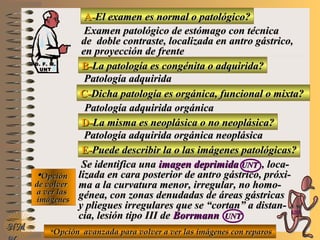 A-A-El examen es normal o patológico?El examen es normal o patológico?
Examen patológico de estómago con técnicaExamen patológico de estómago con técnica
de doble contraste, localizada en antro gástrico,de doble contraste, localizada en antro gástrico,
en proyección de frenteen proyección de frente
B-B-La patología es congénita o adquirida?La patología es congénita o adquirida?
Patología adquiridaPatología adquirida
D-D-La misma es neoplásica o no neoplásica?La misma es neoplásica o no neoplásica?
**OpciónOpción
de volverde volver
a ver lasa ver las
imágenesimágenes
Patología adquirida orgánica neoplásicaPatología adquirida orgánica neoplásica
E-E-Puede describir la o las imágenes patológicas?Puede describir la o las imágenes patológicas?
Se identifica unaSe identifica una imagen deprimidaimagen deprimida UNTUNT , loca-, loca-
lizada en cara posterior de antro gástrico, próxi-lizada en cara posterior de antro gástrico, próxi-
ma a la curvatura menor, irregular, no homo-ma a la curvatura menor, irregular, no homo-
génea, con zonas denudadas de áreas gástricasgénea, con zonas denudadas de áreas gástricas
y pliegues irregulares que se “cortan” a distan-y pliegues irregulares que se “cortan” a distan-
cia, lesión tipo III decia, lesión tipo III de BorrmannBorrmann UNTUNT
NMNM
C-C-Dicha patología es orgánica, funcional o mixta?Dicha patología es orgánica, funcional o mixta?
Patología adquirida orgánicaPatología adquirida orgánica
**Opción avanzada para volver a ver las imágenes con reparosOpción avanzada para volver a ver las imágenes con reparos
D. F. M.D. F. M.
UNTUNT
E ME M
UNTUNT
 