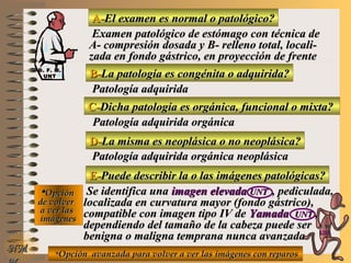 A-A-El examen es normal o patológico?El examen es normal o patológico?
Examen patológico de estómago con técnica deExamen patológico de estómago con técnica de
A- compresión dosada y B- relleno total, locali-A- compresión dosada y B- relleno total, locali-
zada en fondo gástrico, en proyección de frentezada en fondo gástrico, en proyección de frente
B-B-La patología es congénita o adquirida?La patología es congénita o adquirida?
Patología adquiridaPatología adquirida
D-D-La misma es neoplásica o no neoplásica?La misma es neoplásica o no neoplásica?
**OpciónOpción
de volverde volver
a ver lasa ver las
imágenesimágenes
Patología adquirida orgánica neoplásicaPatología adquirida orgánica neoplásica
E-E-Puede describir la o las imágenes patológicas?Puede describir la o las imágenes patológicas?
Se identifica unaSe identifica una imagen elevadaimagen elevada UNTUNT , pediculada,, pediculada,
localizada en curvatura mayor (fondo gástrico),localizada en curvatura mayor (fondo gástrico),
compatible con imagen tipo IV decompatible con imagen tipo IV de YamadaYamada UNTUNT ,,
dependiendo del tamaño de la cabeza puede serdependiendo del tamaño de la cabeza puede ser
benigna o maligna temprana nunca avanzadabenigna o maligna temprana nunca avanzada
NMNM
C-C-Dicha patología es orgánica, funcional o mixta?Dicha patología es orgánica, funcional o mixta?
Patología adquirida orgánicaPatología adquirida orgánica
**Opción avanzada para volver a ver las imágenes con reparosOpción avanzada para volver a ver las imágenes con reparos
D. F. M.D. F. M.
UNTUNT
E ME M
UNTUNT
 