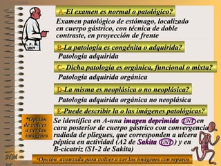 A-A-El examen es normal o patológico?El examen es normal o patológico?
Examen patológico de estómago, localizadoExamen patológico de estómago, localizado
en cuerpo gástrico, con técnica de dobleen cuerpo gástrico, con técnica de doble
contraste, en proyección de frentecontraste, en proyección de frente
B-B-La patología es congénita o adquirida?La patología es congénita o adquirida?
Patología adquiridaPatología adquirida
C-C- Dicha patología es orgánica, funcional o mixta?Dicha patología es orgánica, funcional o mixta?
**OpciónOpción
de volverde volver
a ver lasa ver las
imágenesimágenes
Patología adquirida orgánicaPatología adquirida orgánica
D-D-La misma es neoplásica o no neoplásica?La misma es neoplásica o no neoplásica?
Patología adquirida orgánica no neoplásicaPatología adquirida orgánica no neoplásica
E-E-Puede describir la o las imágenes patológicas?Puede describir la o las imágenes patológicas?
Se identifica en A-unaSe identifica en A-una imagen deprimidaimagen deprimida UNTUNT enen
cara posterior de cuerpo gástrico con convergenciacara posterior de cuerpo gástrico con convergencia
radiada de pliegues, que corresponden a ulceraradiada de pliegues, que corresponden a ulcera
péptica en actividad (A2 depéptica en actividad (A2 de SakitaSakita UNTUNT ) y en) y en
B-cicatriz (S1-2 de Sakita)B-cicatriz (S1-2 de Sakita)
**Opción avanzada para volver a ver las imágenes con reparosOpción avanzada para volver a ver las imágenes con reparosNMNM
D. F. M.D. F. M.
UNTUNT
E ME M
UNTUNT
 