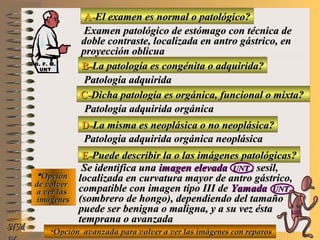A-A-El examen es normal o patológico?El examen es normal o patológico?
Examen patológico de estómago con técnica deExamen patológico de estómago con técnica de
doble contraste, localizada en antro gástrico, endoble contraste, localizada en antro gástrico, en
proyección oblicuaproyección oblicua
B-B-La patología es congénita o adquirida?La patología es congénita o adquirida?
Patología adquiridaPatología adquirida
D-D-La misma es neoplásica o no neoplásica?La misma es neoplásica o no neoplásica?
**OpciónOpción
de volverde volver
a ver lasa ver las
imágenesimágenes
Patología adquirida orgánica neoplásicaPatología adquirida orgánica neoplásica
E-E-Puede describir la o las imágenes patológicas?Puede describir la o las imágenes patológicas?
Se identifica unaSe identifica una imagen elevadaimagen elevada UNTUNT , sesil,, sesil,
localizada en curvatura mayor de antro gástrico,localizada en curvatura mayor de antro gástrico,
compatible con imagen tipo III decompatible con imagen tipo III de YamadaYamada UNTUNT
(sombrero de hongo), dependiendo del tamaño(sombrero de hongo), dependiendo del tamaño
puede ser benigna o maligna, y a su vez éstapuede ser benigna o maligna, y a su vez ésta
temprana o avanzadatemprana o avanzada
NMNM
C-C-Dicha patología es orgánica, funcional o mixta?Dicha patología es orgánica, funcional o mixta?
Patología adquirida orgánicaPatología adquirida orgánica
**Opción avanzada para volver a ver las imágenes con reparosOpción avanzada para volver a ver las imágenes con reparos
D. F. M.D. F. M.
UNTUNT
E ME M
UNTUNT
 