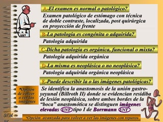 A-A-El examen es normal o patológico?El examen es normal o patológico?
Examen patológico de estómago con técnicaExamen patológico de estómago con técnica
de doble contraste, localizada, post quirúrgicade doble contraste, localizada, post quirúrgica
en proyección de frenteen proyección de frente
B-B-La patología es congénita o adquirida?La patología es congénita o adquirida?
Patología adquiridaPatología adquirida
D-D-La misma es neoplásica o no neoplásica?La misma es neoplásica o no neoplásica?
**OpciónOpción
de volverde volver
a ver lasa ver las
imágenesimágenes
Patología adquirida orgánica neoplásicaPatología adquirida orgánica neoplásica
E-E-Puede describir la o las imágenes patológicas?Puede describir la o las imágenes patológicas?
Se identifica la anastomosis de la unión gastro-Se identifica la anastomosis de la unión gastro-
yeyunal (Billroth II) donde se evidencian residibayeyunal (Billroth II) donde se evidencian residiba
de lesión neoplásica, sobre ambos bordes de lade lesión neoplásica, sobre ambos bordes de la
““boca” anastomótica se distinguenboca” anastomótica se distinguen imágenesimágenes
elevadaselevadas UNTUNT tipo I detipo I de BorrmannBorrmann UNTUNT
NMNM
C-C-Dicha patología es orgánica, funcional o mixta?Dicha patología es orgánica, funcional o mixta?
Patología adquirida orgánicaPatología adquirida orgánica
**Opción avanzada para volver a ver las imágenes con reparosOpción avanzada para volver a ver las imágenes con reparos
D. F. M.D. F. M.
UNTUNT
E ME M
UNTUNT
 