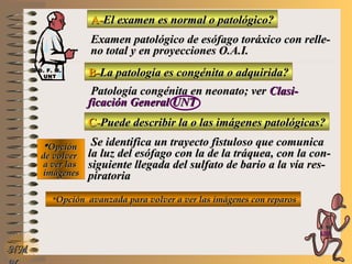 A-A-El examen es normal o patológico?El examen es normal o patológico?
Examen patológico de esófago toráxico con relle-Examen patológico de esófago toráxico con relle-
no total y en proyecciones O.A.I.no total y en proyecciones O.A.I.
B-B-La patología es congénita o adquirida?La patología es congénita o adquirida?
Patología congénita en neonato; verPatología congénita en neonato; ver Clasi-Clasi-
ficación General UNTficación General UNT
C-C-Puede describir la o las imágenes patológicas?Puede describir la o las imágenes patológicas?
**OpciónOpción
de volverde volver
a ver lasa ver las
imágenesimágenes
Se identifica un trayecto fistuloso que comunicaSe identifica un trayecto fistuloso que comunica
la luz del esófago con la de la tráquea, con la con-la luz del esófago con la de la tráquea, con la con-
siguiente llegada del sulfato de bario a la vía res-siguiente llegada del sulfato de bario a la vía res-
piratoriapiratoria
**Opción avanzada para volver a ver las imágenes con reparosOpción avanzada para volver a ver las imágenes con reparos
NMNM
D. F. M.D. F. M.
UNTUNT
E ME M
UNTUNT
 